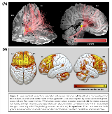 NNHFHMUU-1074839-2-IMG(1)